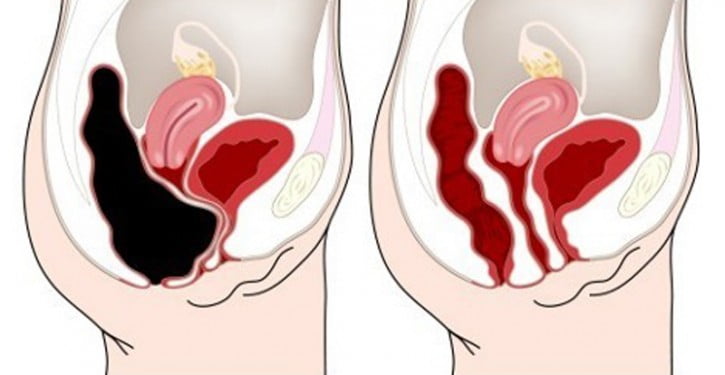 appuyer-point-de-ventre-eliminer-toxines-colon