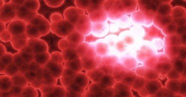 Cancer Du Cerveau Les Signes