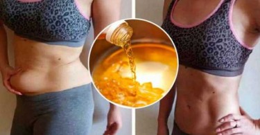 Les masques effectifs pour les cheveux de seborei