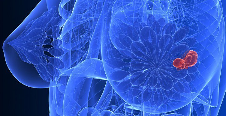 Ce beurre peut favoriser l&rsquo;acné, le cancer du sein et de la prostate