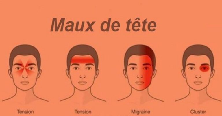 Les 4 types de maux de tête les plus dangereux que vous ne devriez pas ignorer