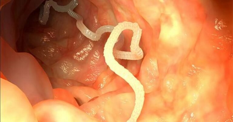 C&rsquo;est l&rsquo;antibiotique naturel le plus puissant que vous puissiez imaginer. Il peut guérir toutes les infections et tuer les parasites dans le corps.