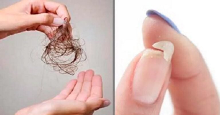 Chute de cheveux, troubles du sommeil et ongles fragiles? C&rsquo;est définitivement de la nourriture à consommer …