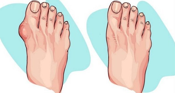 Utilisez ces 4 remèdes naturels pour vous débarrasser des effets des oignons. L&rsquo;effet sera immédiat!