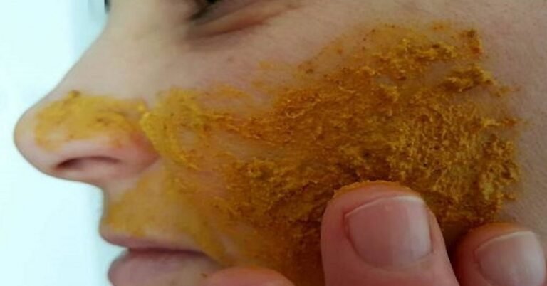 Elle a frotté du curcuma sur son visage pendant 3 secondes … il faut essayer de le convaincre!