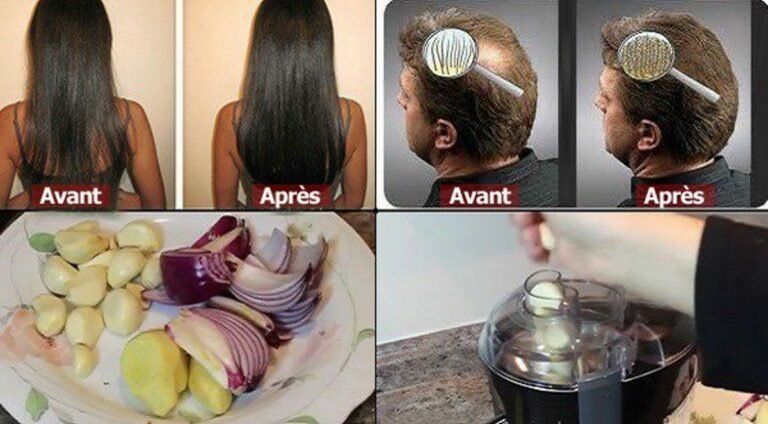 incroyable! Les cheveux de cette femme sont devenus magnifiques … et n&rsquo;utilisez qu&rsquo;un seul ingrédient que nous avons tous!