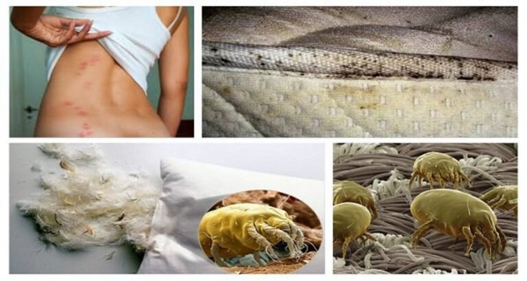 Nos matelas contiennent en moyenne 1,5 million d&rsquo;espèces d&rsquo;acariens, c&rsquo;est une méthode en une étape pour les éliminer!