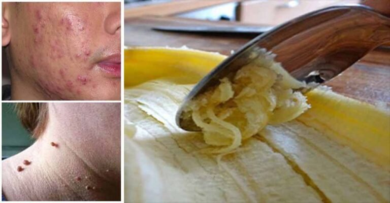 Après avoir lu cet article, vous ne perdrez plus jamais cette partie de la banane!