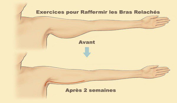 Bras détendu: 4 types d&rsquo;exercices peuvent éliminer l&rsquo;accumulation de graisse dans le bras …