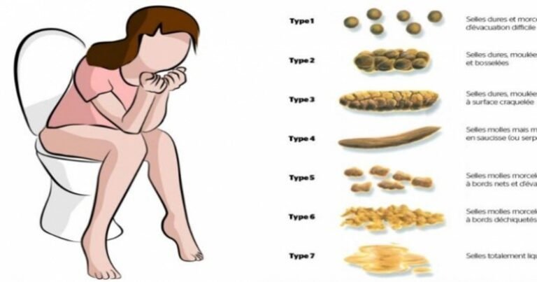 Regardez le pot après la défécation, il montre votre santé! Plusieurs réponses sur des sujets hautement tabous!
