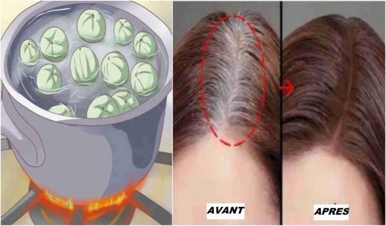 Dites adieu aux cheveux gris! Après avoir appliqué cette thérapie pendant 5 minutes, vous ne reverrez plus jamais les cheveux gris!