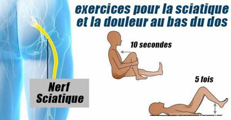Résultats instantanés: Six meilleurs exercices pour soulager la sciatique et le bas du dos!