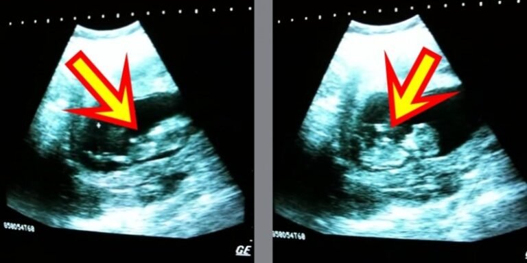 Ce bébé fait des choses très intéressantes dans le ventre de sa mère!