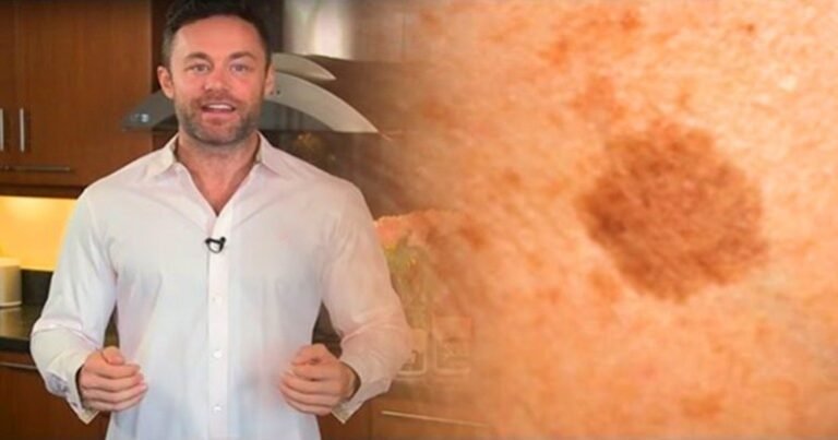 Un dermatologue réputé a révélé comment éliminer ces taches brunes avec seulement deux ingrédients très inoffensifs!
