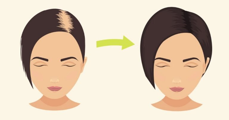 En appliquant ce shampooing au bicarbonate de soude sur vos cheveux, quelque chose d&rsquo;incroyable va se passer … J&rsquo;essaye