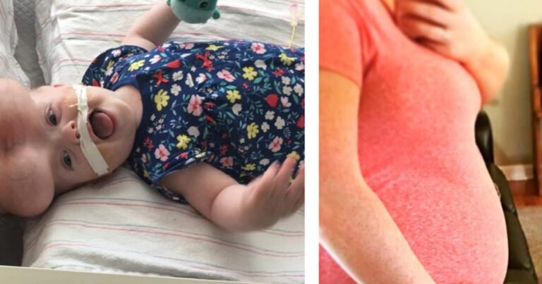 La femme a appris qu&rsquo;elle attendait des jumeaux – 11 semaines plus tard, le médecin lui a donné des nouvelles choquantes