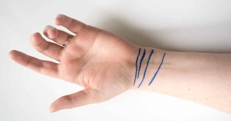 Découvrez ce que signifient les lignes sur le poignet