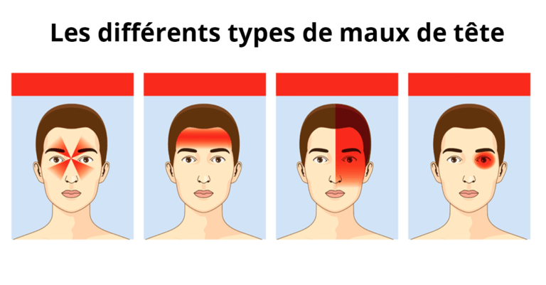 Le type de mal de tête que vous ressentez indique votre état de santé général