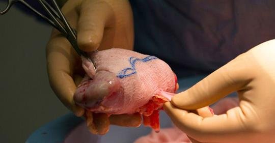 10 habitudes qui endommagent gravement les reins