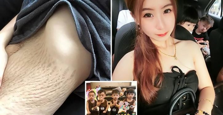 Une mère de 23 ans âgée de quatre enfants a fièrement montré ses vergetures après avoir appris qu&rsquo;elle avait «ruiné» son corps