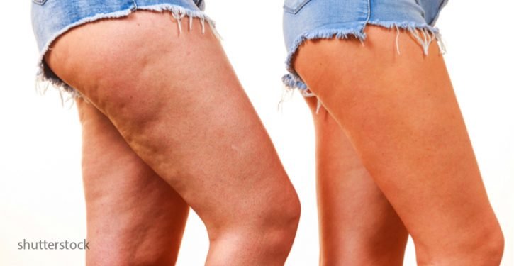 Vous devez marcher tous les jours, cela a huit avantages majeurs pour votre santé