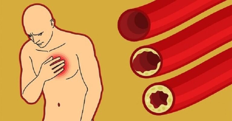 9 aliments dans la cuisine aident à dégager les artères