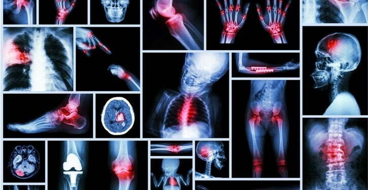 L&rsquo;humeur dépressive devient une maladie