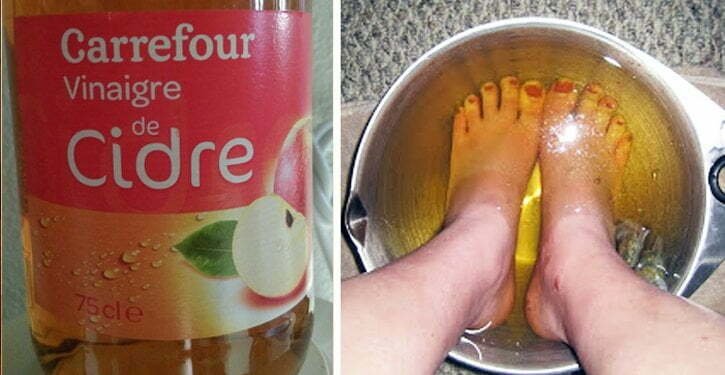 Tremper les pieds avec du vinaigre peut guérir de nombreux problèmes de santé