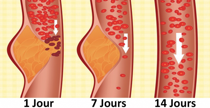 Le médecin a dit que le régime DASH est le meilleur pour votre santé. Il peut prévenir les accidents vasculaires cérébraux, le diabète, vous aider à perdre du poids et être bénéfique pour votre cœur.