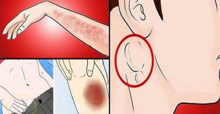 15 signes de cancer que les gens ignorent