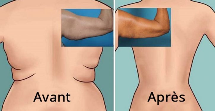 6 types d&rsquo;exercices pour brûler les graisses pour renforcer le dos et les aisselles