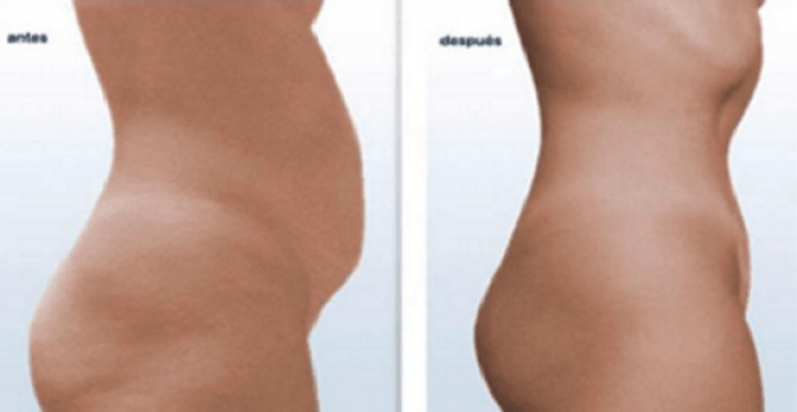 Avec cette formule naturelle, vous pouvez dire adieu à la graisse du ventre en seulement deux semaines