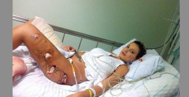 Elle a perdu la capacité d&rsquo;utiliser ses jambes après une chirurgie plastique