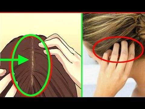 Les cheveux peuvent prédire le risque de maladie cardiaque des mois à l’avance! Voici comment faire!