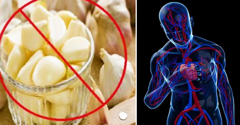 Dans 6 cas, vous devez arrêter de manger de l&rsquo;ail immédiatement! très dangereux!