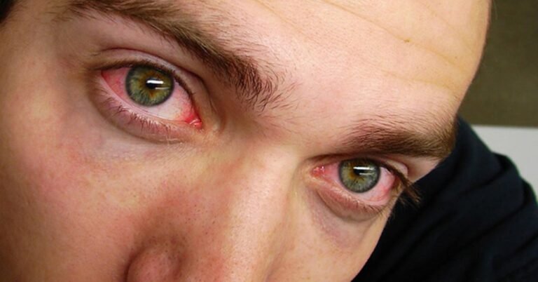 Moins de 7 heures de sommeil par nuit peuvent avoir des effets graves sur notre corps: en voici quelques