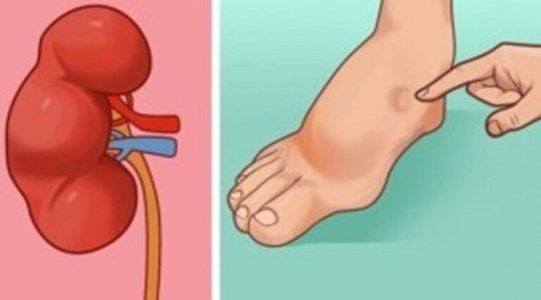 Votre corps vous avertira d&rsquo;un accident vasculaire cérébral