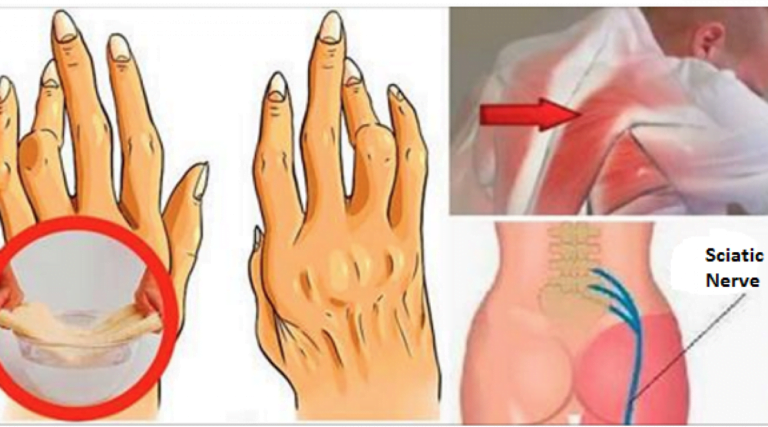 Utilisez cette technique d&rsquo;huile de ricin pour soulager les douleurs articulaires