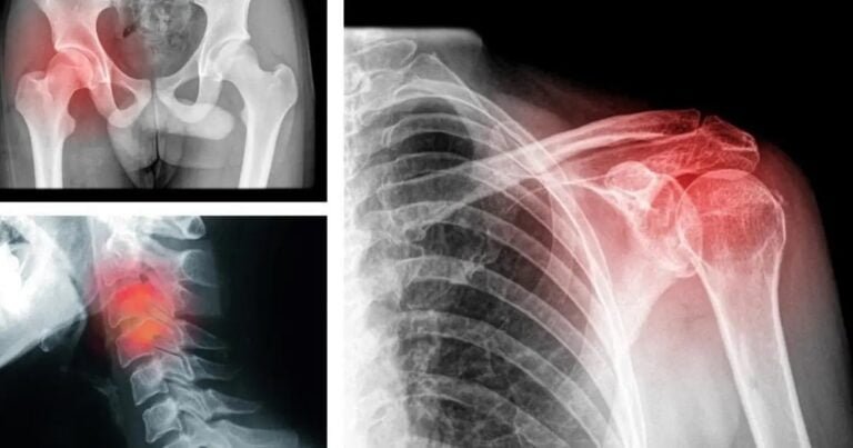 9 douleurs directement liées à l’état émotionnel