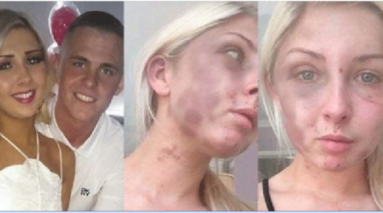 Cette femme a été brutalement battue par son petit ami, mobilisons-nous pour lutter contre les violences faites aux femmes