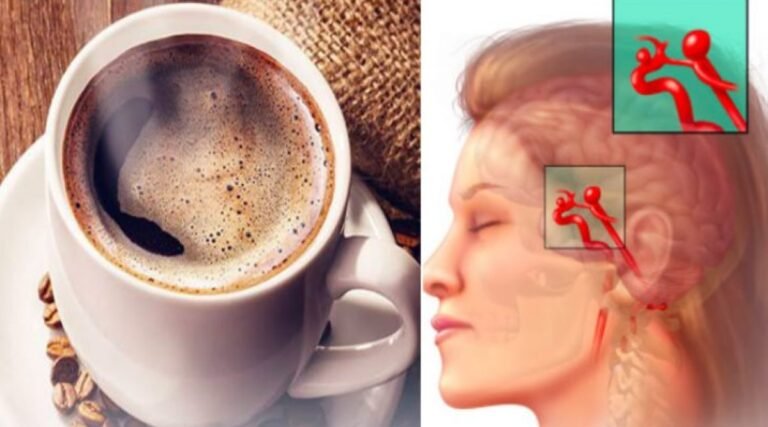 8 choses quotidiennes qui peuvent déclencher une rupture d’anévrisme cérébral (AVC)