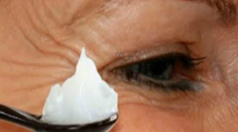 Si vous avez plus de 35 ans et avez des rides, essuyez avec cet ingrédient pour réduire les rides