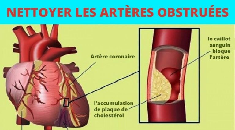 Ces aliments protègent votre cœur et libèrent les artères