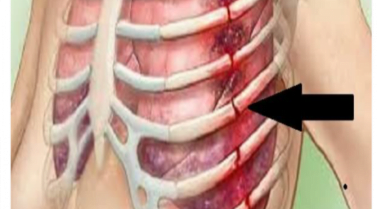 Dangers pour la santé du soda