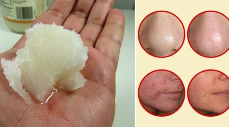 C&rsquo;est le moyen de se laver le visage et de dire adieu au relâchement et aux rides