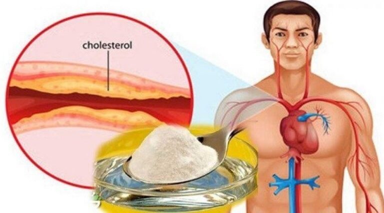 Remèdes naturels contre le cholestérol et l&rsquo;hypertension artérielle