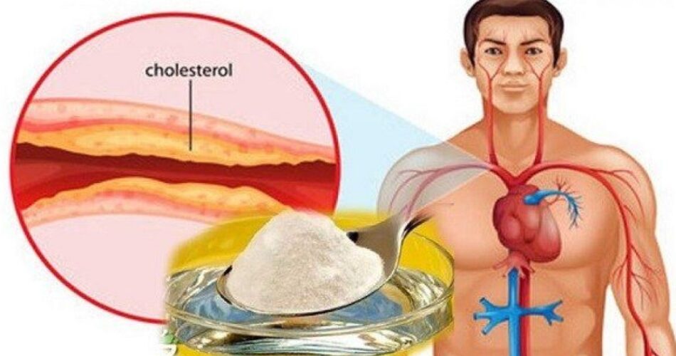 Remèdes Naturels Contre Le Cholestérol Et Lhypertension Artérielle Esprit And Santé 