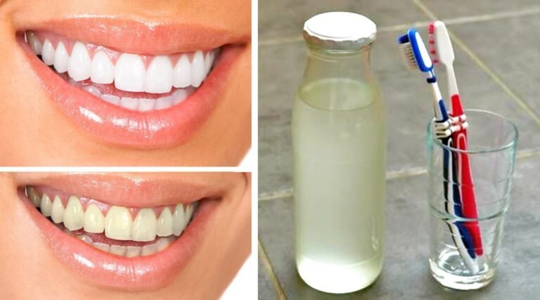 Voici comment fabriquer un bain de bouche naturel sans alcool