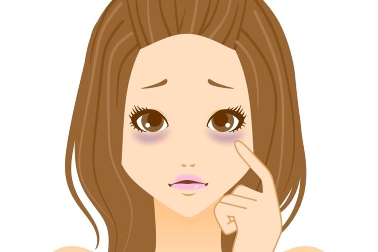 4 raisons pour lesquelles vous ne pouvez pas vous débarrasser des cernes sous vos yeux