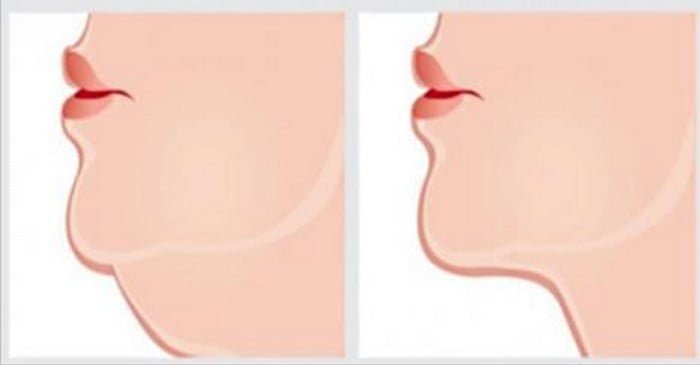 Les meilleurs exercices pour se débarrasser de ce double menton indésirable